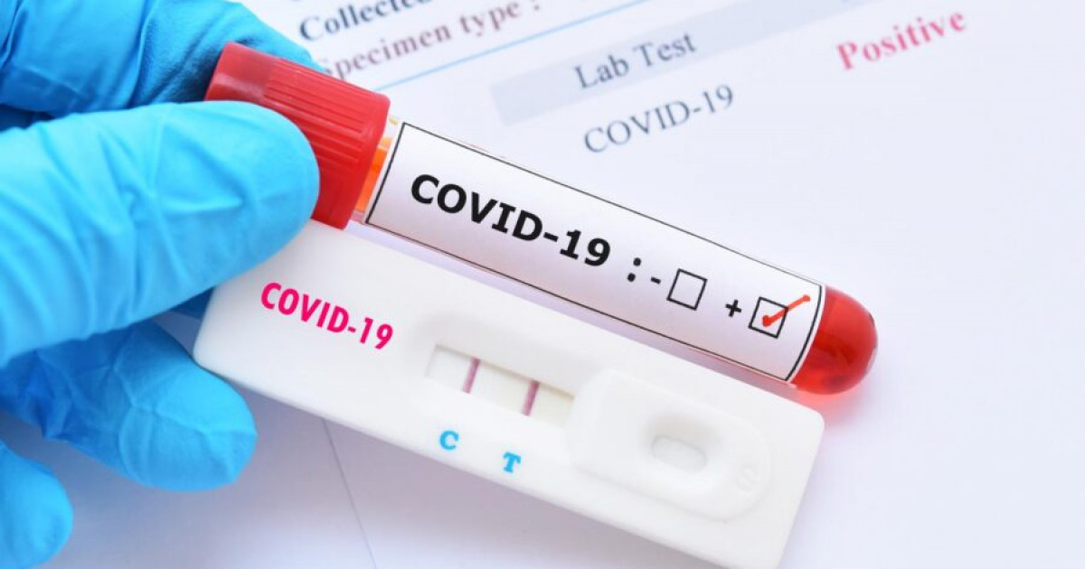 კორონავირუსზე PCR ტესტირება პირველი მარტიდან სახელმწიფო პროგრამის ფარგლებში აღარ დაფინანსდება
