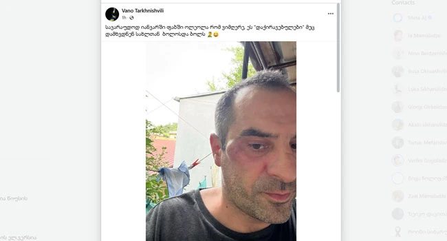 მსახიობი და მომღერალი ვანიკო თარხნიშვილი სცემეს